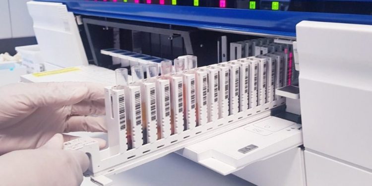 Laboratório do Hospital Delphina Aziz já realizou mais de meio milhão de exames em 2021