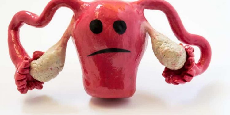 Ginecologista alerta para os casos de mioma