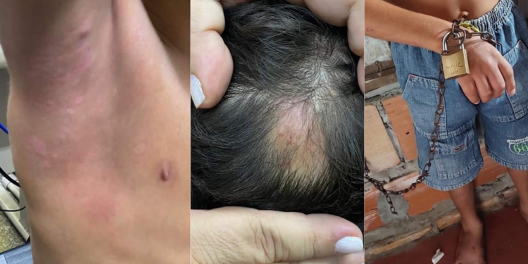 Menino resgatado pela PM era acorrentado e espancado pelo pai e madrasta em Manaus