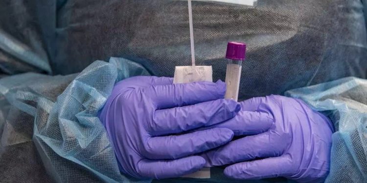 Flurona: quais sintomas quando os vírus da gripe e da Covid atacam juntos