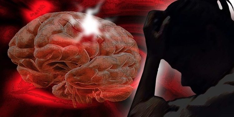 Estudos apontam aumento da incidência de AVC em mulheres jovens