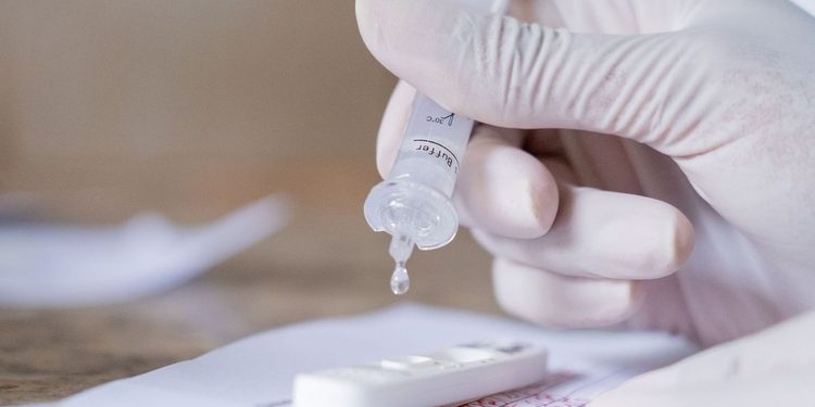 Com 3º dia sem mortes por Covid, Amazonas registra 45 novos casos da doença